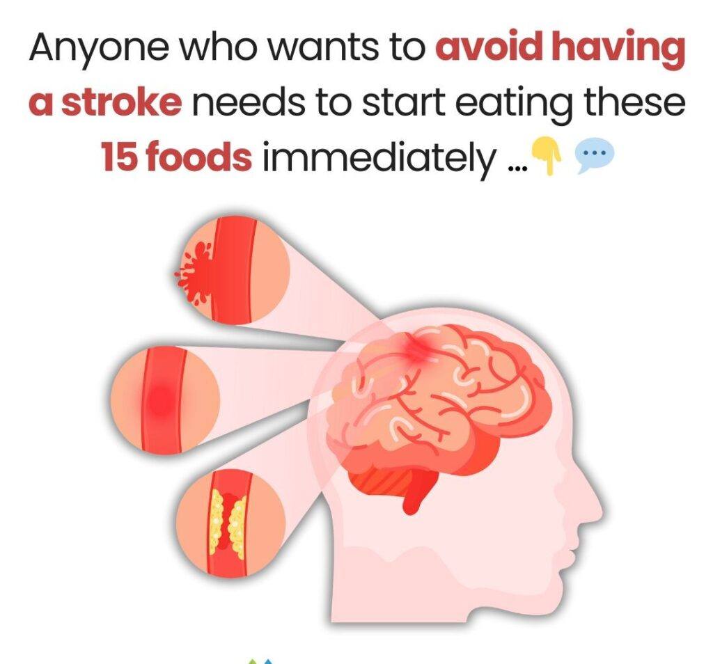 Anyone Who Wants to Avoid Having a Stroke Needs to Start Eating these 15 Foods Immediately
