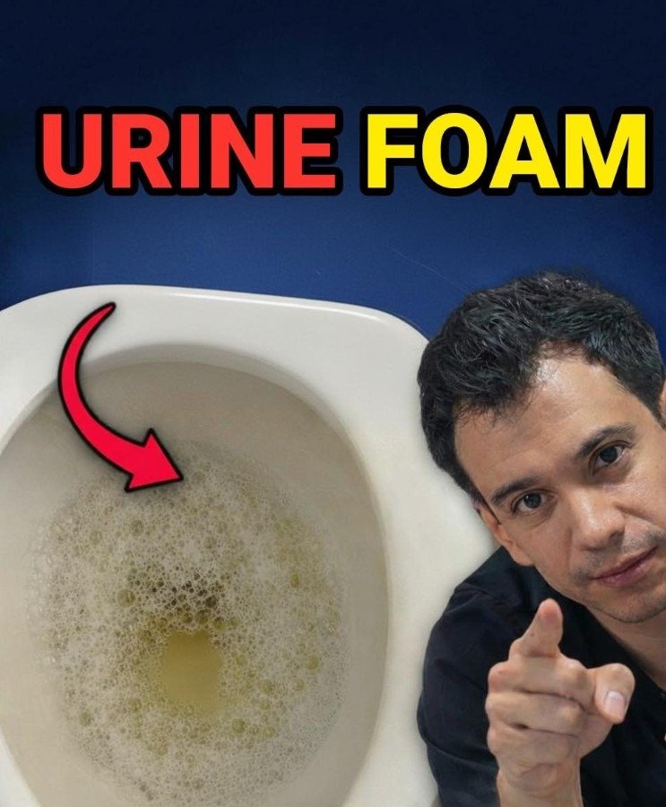 What Does Foamy Urine Mean? Causes, Myths, and When to Worry